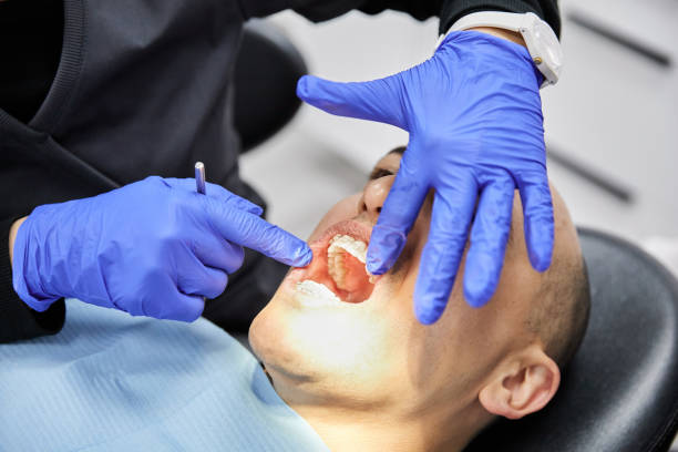 Best Chipped Tooth Repair Near Me  in Murrells Inlet, SC