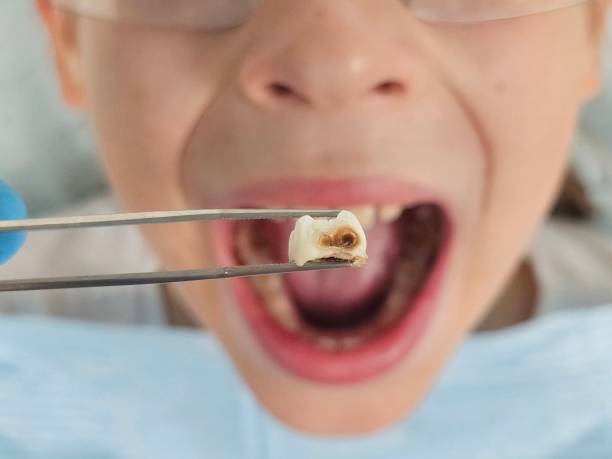 Dentist for Dental Trauma in SC